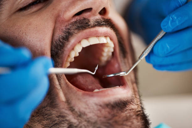 Best Tooth Pain Emergency Relief  in Inola, OK