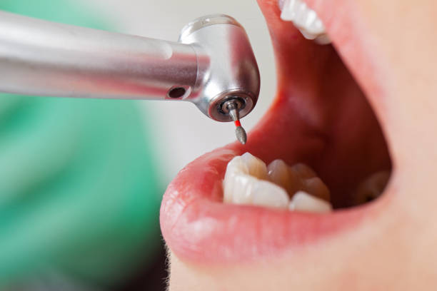 Best Root Canal Emergency Dentist  in Inola, OK